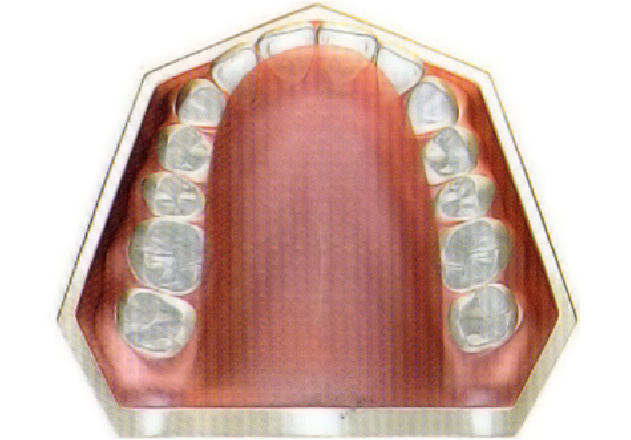 歯の模型2